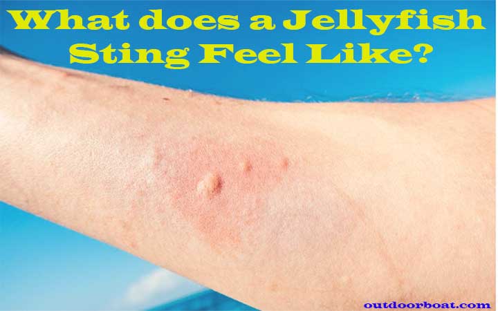 What does a Jellyfish Sting Feel Like?